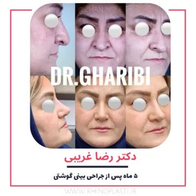 تصاویر گالری بیماران دکتر رضا غریبی