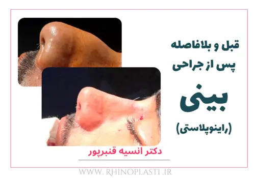 تصاویر گالری بیماران دکتر انسیه قنبرپور