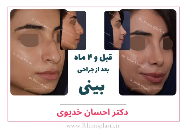 تصاویر جراحی دکتر احسان خدیوی