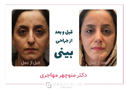 تصاویر گالری بیماران دکتر منوچهر مهاجری