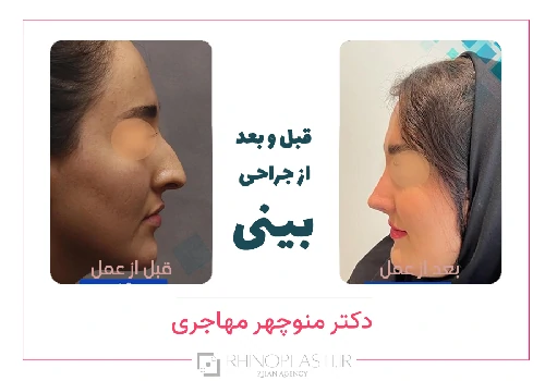 تصاویر گالری بیماران دکتر منوچهر مهاجری