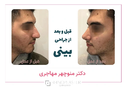 تصاویر گالری بیماران دکتر منوچهر مهاجری