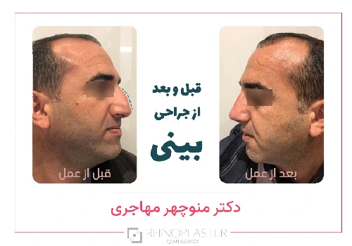 تصاویر گالری بیماران دکتر منوچهر مهاجری