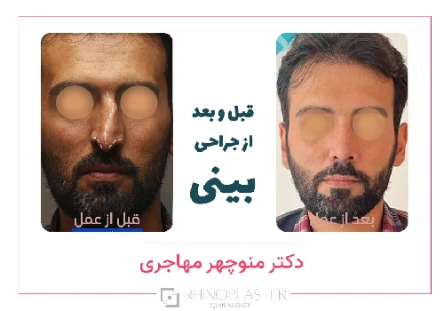 تصاویر گالری بیماران دکتر منوچهر مهاجری