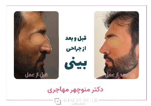 تصاویر گالری بیماران دکتر منوچهر مهاجری