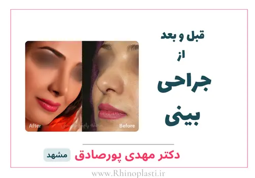 تصاویر گالری بیماران دکتر مهدی پورصادق