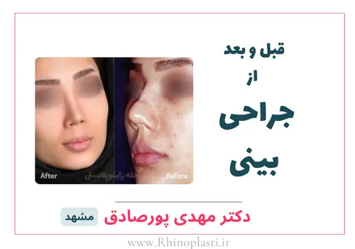 تصاویر گالری بیماران دکتر مهدی پورصادق