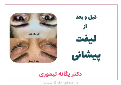 تصاویر گالری بیماران دکتر یگانه تیموری