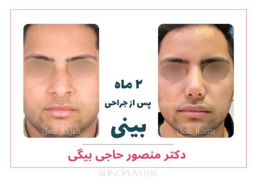 تصاویر جراحی دکتر منصور حاجی بیگی