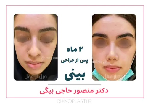 تصاویر جراحی دکتر منصور حاجی بیگی