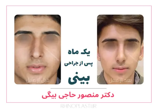 تصاویر جراحی دکتر منصور حاجی بیگی