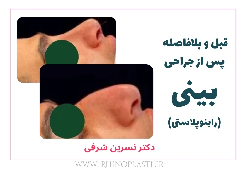 تصاویر گالری بیماران دکتر نسرین شرفی
