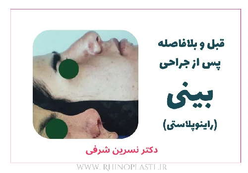 تصاویر گالری بیماران دکتر نسرین شرفی