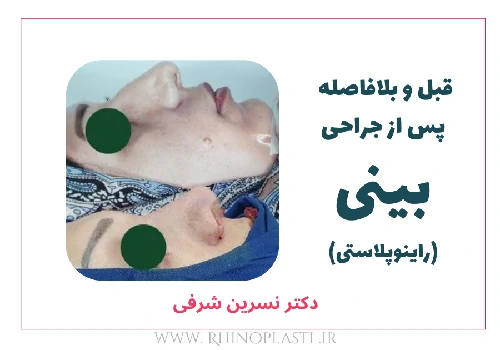 تصاویر گالری بیماران دکتر نسرین شرفی