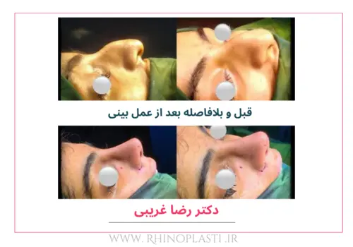 تصاویر جراحی دکتر رضا غریبی