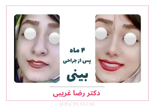 تصاویر جراحی دکتر رضا غریبی