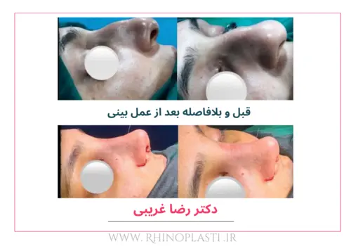 تصاویر گالری بیماران دکتر رضا غریبی