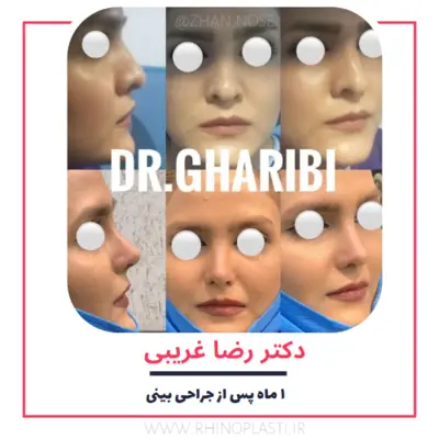 تصاویر گالری بیماران دکتر رضا غریبی