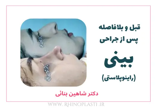 تصاویر گالری بیماران دکتر شاهین بنایی
