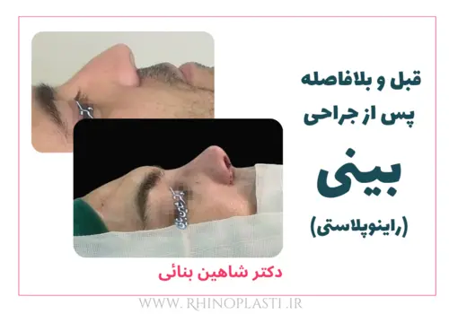 تصاویر گالری بیماران دکتر شاهین بنایی